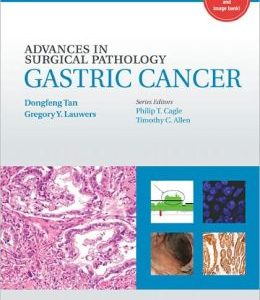 Advances in Surgical Pathology: Gastric Cancer (ORIGINAL PDF from Publisher)