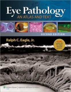 Eye Pathology: An Atlas and Text, 2nd Edition (ORIGINAL PDF from Publisher)