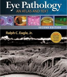 Eye Pathology: An Atlas and Text, 2nd Edition (ORIGINAL PDF from Publisher)