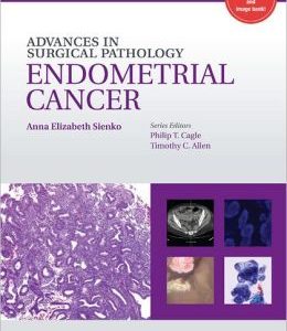 Advances in Surgical Pathology: Endometrial Carcinoma (ORIGINAL PDF from Publisher)