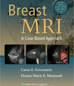 Breast MRI: A Case-Based Approach (ORIGINAL PDF from Publisher)