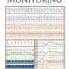 Handbook of ICU EEG Monitoring (Original PDF from Publisher)