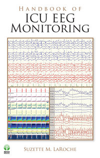 Handbook of ICU EEG Monitoring (Original PDF from Publisher)