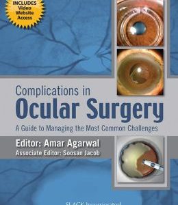 Complications in Ocular Surgery: A Guide to Managing the Most Common Challenges (ORIGINAL PDF from Publisher)