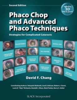 Phaco Chop and Advanced Phaco Techniques: Strategies for Complicated Cataracts (ORIGINAL PDF from Publisher)
