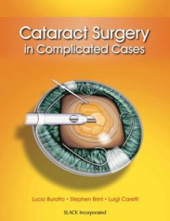 Cataract Surgery in Complicated Cases (ORIGINAL PDF from Publisher)