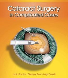Cataract Surgery in Complicated Cases (ORIGINAL PDF from Publisher)