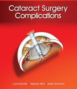 Cataract Surgery Complications (ORIGINAL PDF from Publisher)