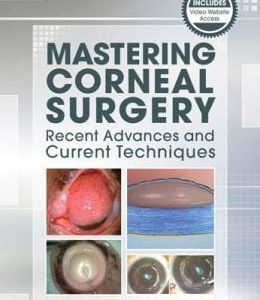 Mastering Corneal Surgery: Recent Advances and Current Techniques (ORIGINAL PDF from Publisher)