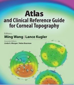Atlas and Clinical Reference Guide for Corneal Topography (ORIGINAL PDF from Publisher)