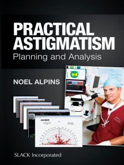 Practical Astigmatism: Planning and Analysis (EPUB)