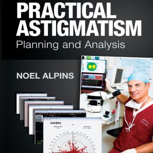 Practical Astigmatism: Planning and Analysis (EPUB)
