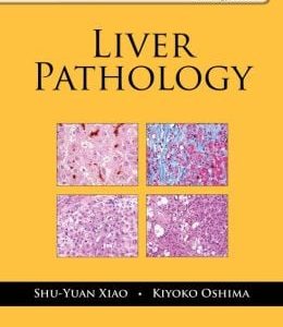 Liver Pathology (Demos Surgical Pathology Guides)