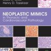 Neoplastic Mimics in Thoracic and Cardiovascular Pathology