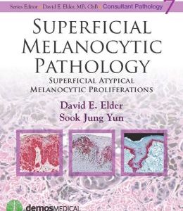 Superficial Melanocytic Pathology