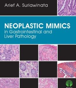 Neoplastic Mimics in Gastrointestinal and Liver Pathology