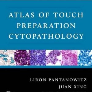 Atlas of Touch Preparation Cytopathology (PDF)