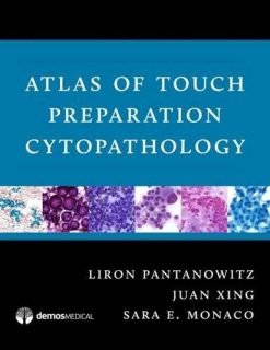 Atlas of Touch Preparation Cytopathology (EPUB)
