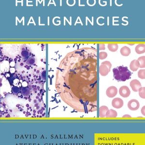 Handbook of Hematologic Malignancies (PDF)