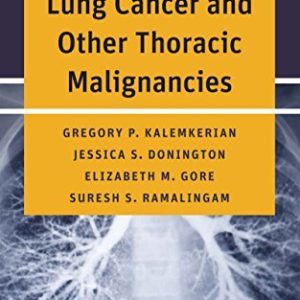 Handbook of Lung Cancer and Other Thoracic Malignancies (PDF)