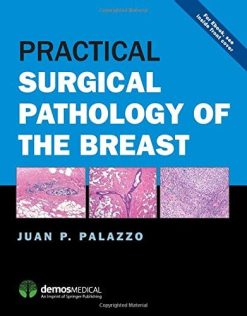 Practical Surgical Pathology of the Breast (PDF)