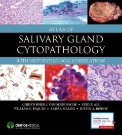 Atlas of Salivary Gland Cytopathology: with Histopathologic Correlations (PDF)