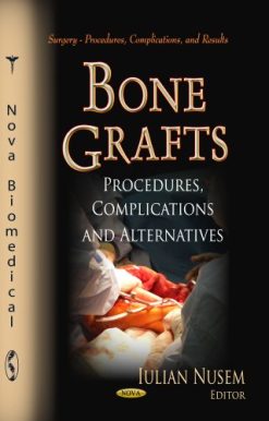 Bone Grafts: Procedures, Complications and Alternatives (Surgery – Procedures, Complications, and Results)  (Original PDF from Publisher)