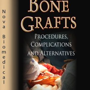 Bone Grafts: Procedures, Complications and Alternatives (Surgery – Procedures, Complications, and Results) (Original PDF from Publisher)