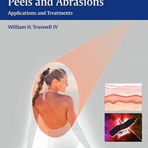 Lasers and Light, Peels and Abrasions: Applications and Treatments (ORIGINAL PDF from Publisher)