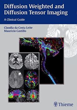 Diffusion Weighted and Diffusion Tensor Imaging: A Clinical Guide (ORIGINAL PDF from Publisher)
