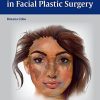 Ethnic Considerations in Facial Plastic Surgery (ORIGINAL PDF from Publisher)
