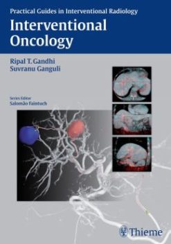 Interventional Oncology (Practical Guides in Interventional Radiology)
