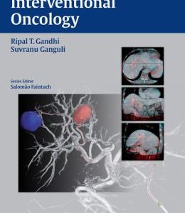 Interventional Oncology (Practical Guides in Interventional Radiology)