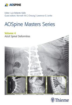 AOSpine Master Series, Vol. 4: Adult Spinal Deformities (AOSpine Masters Series) (PDF)