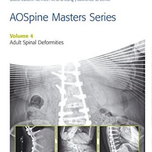 AOSpine Master Series, Vol. 4: Adult Spinal Deformities (AOSpine Masters Series) (PDF)