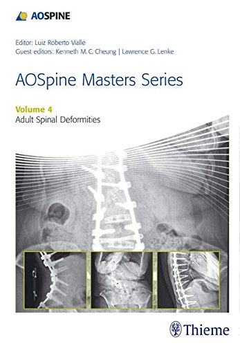 AOSpine Master Series, Vol. 4: Adult Spinal Deformities (AOSpine Masters Series) (PDF)