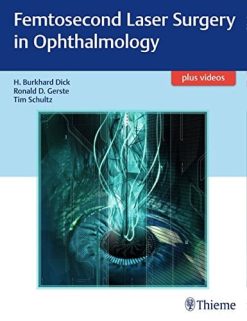 Femtosecond Laser Surgery in Ophthalmology (EPUB)