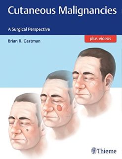 Cutaneous Malignancies: A Surgical Perspective (Original PDF from Publisher + Videos)