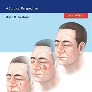 Cutaneous Malignancies: A Surgical Perspective (Original PDF from Publisher + Videos)