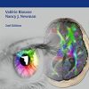 Neuro-Ophthalmology Illustrated, 2nd Edition (EPUB)