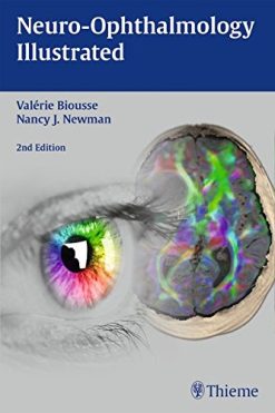 Neuro-Ophthalmology Illustrated, 2nd Edition (EPUB)