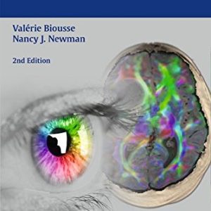 Neuro-Ophthalmology Illustrated, 2nd Edition (ORIGINAL PDF from Publisher)