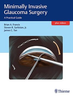 Minimally Invasive Glaucoma Surgery: A Practical Guide (PDF)