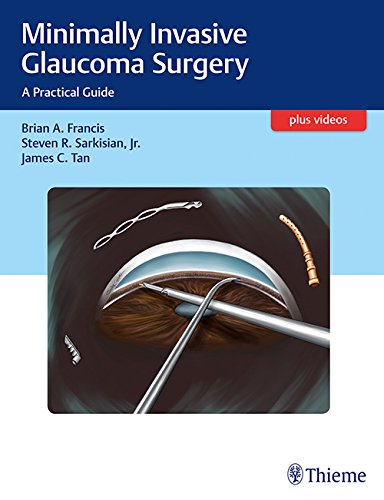 Minimally Invasive Glaucoma Surgery: A Practical Guide (EPUB)