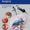 Neuroendoscopic Surgery (PDF)