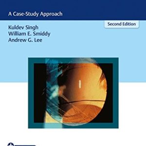 Ophthalmology Review: A Case-Study Approach, 2ed (PDF)