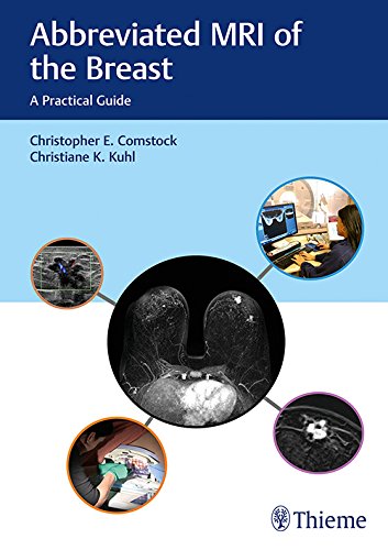 Abbreviated MRI of the Breast: A Practical Guide (EPUB)