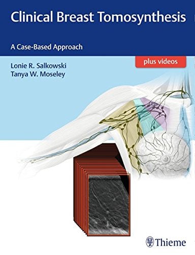 Clinical Breast Tomosynthesis: A Case-Based Approach (PDF)