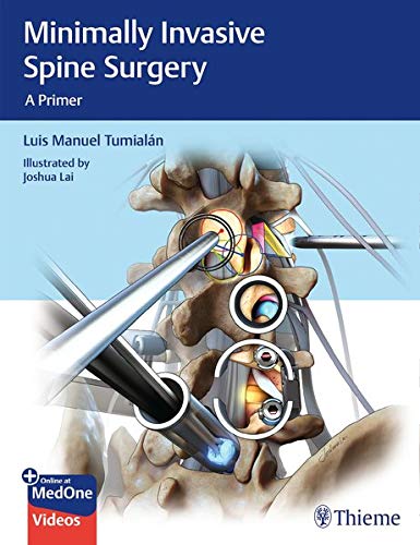 Minimally Invasive Spine Surgery: A Primer (Original PDF from Publisher+Videos)