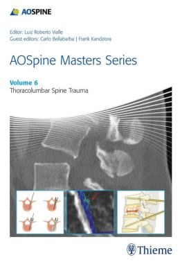 AOSpine Masters Series, Volume 6: Thoracolumbar Spine Trauma (ORIGINAL PDF from Publisher)
